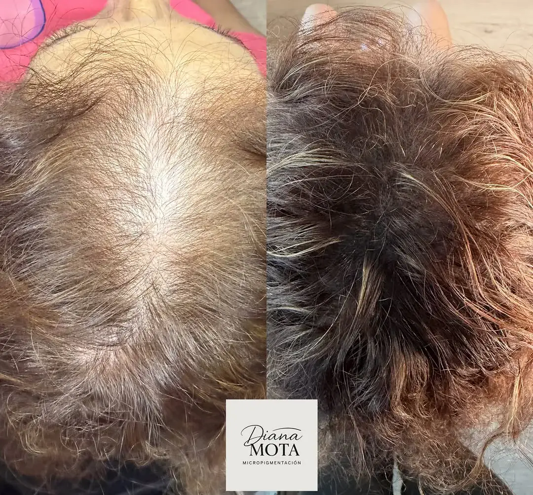Antes y después: Efecto densidad